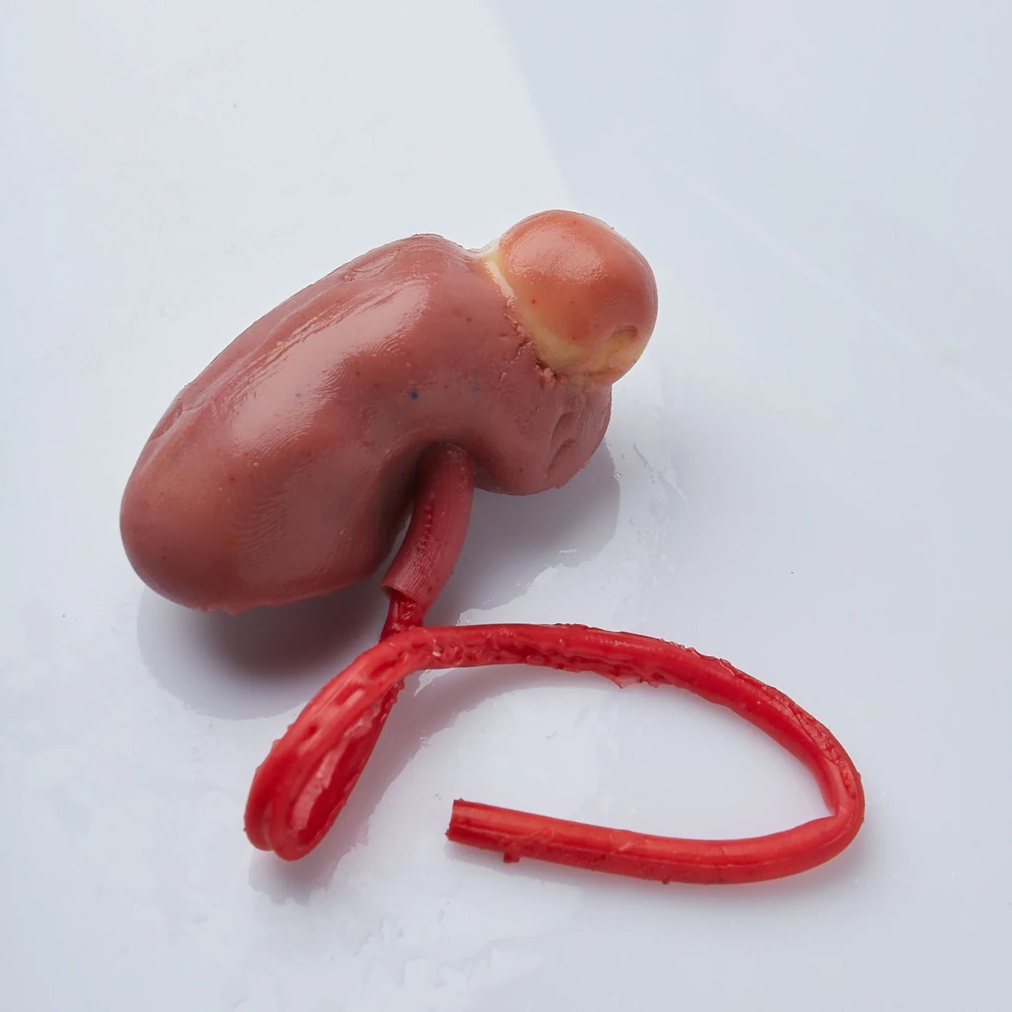 Partial Nephrectomy (Class II)