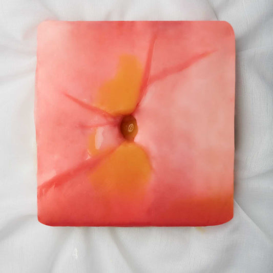 Ventral Hernia (Class II) - Hydrogel Surgical Training Model
