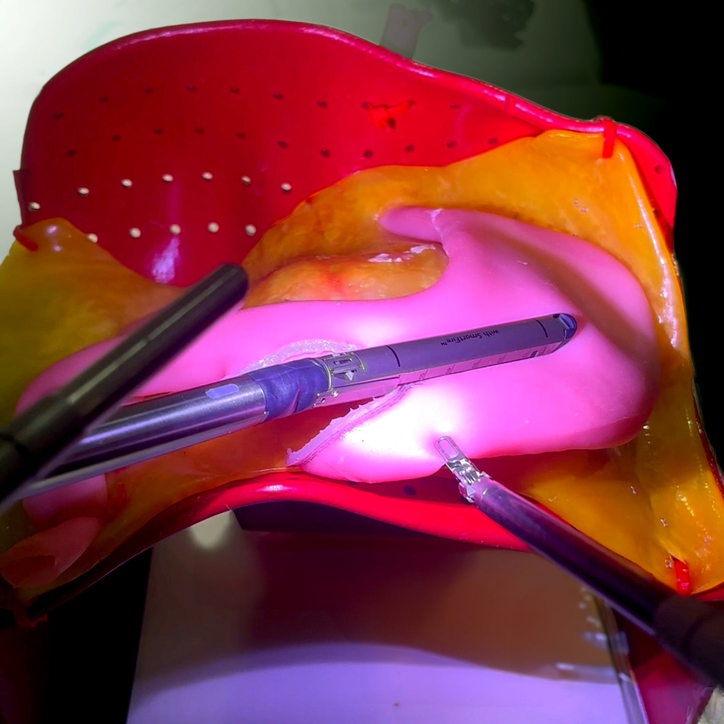 Gastric Model (Class II) - Hydrogel Surgical Training Model