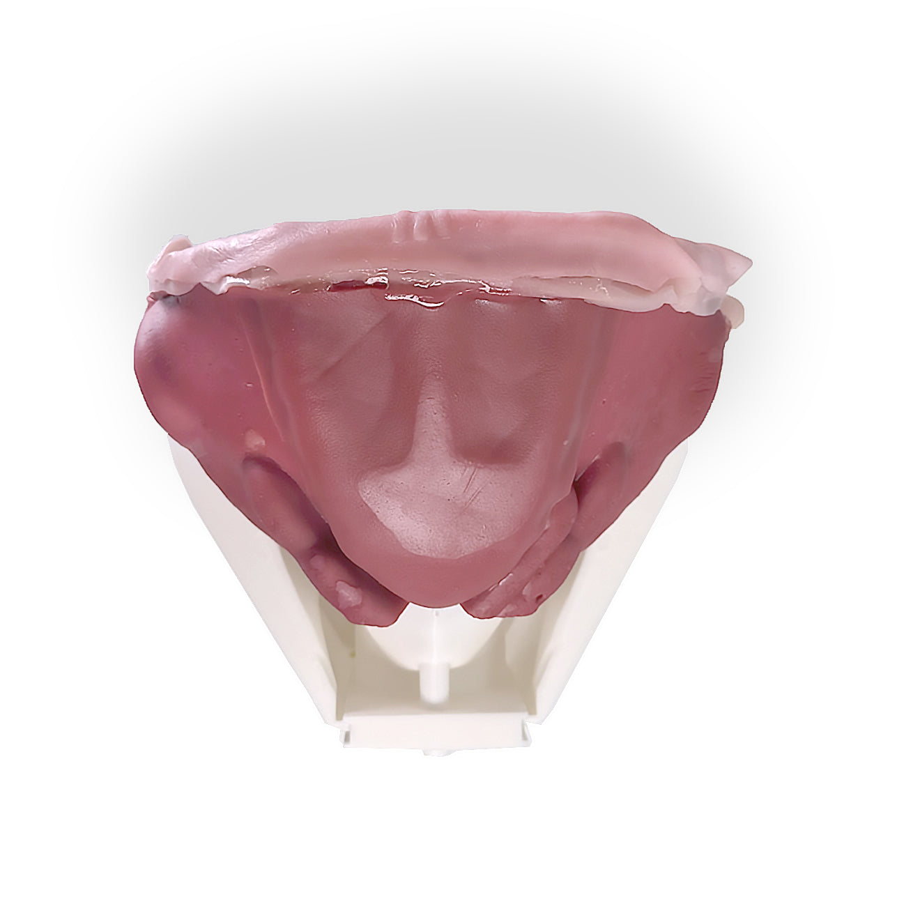 Hydrogel Surgical Training Model - Inguinal Hernia Class IV