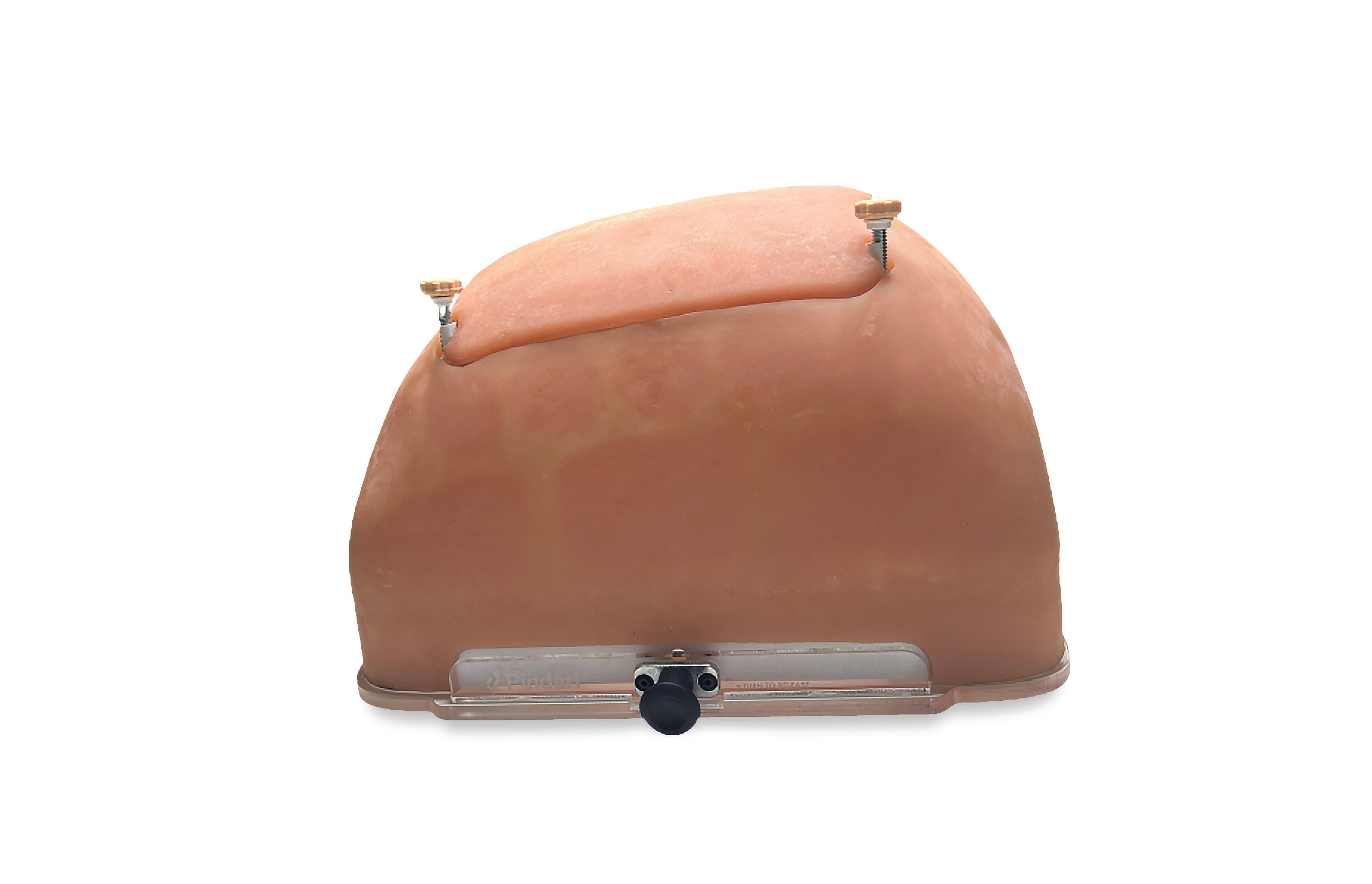 Abdome