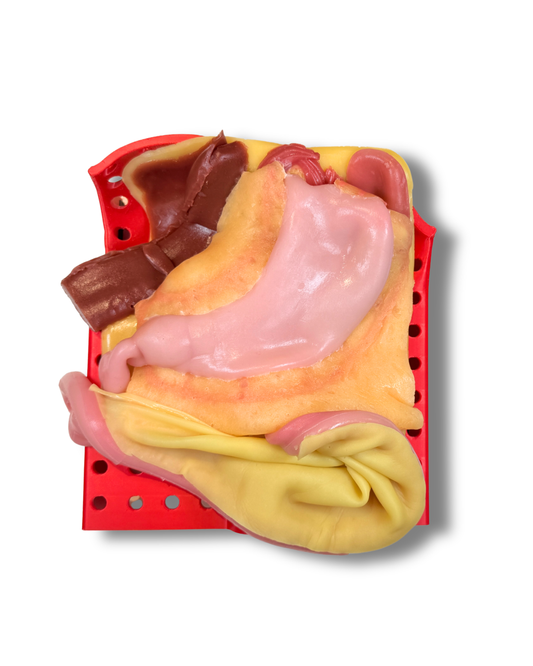 Gastric (Class IV)