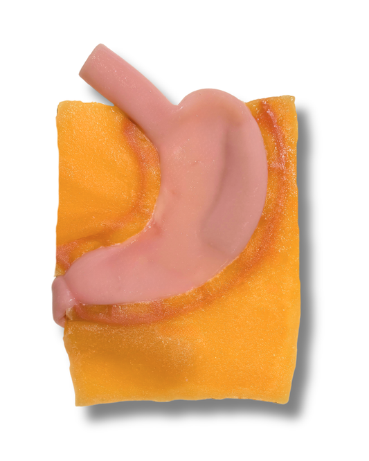 Gastric (Class III)