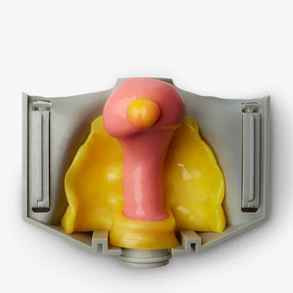 Myomectomy (Class II)
