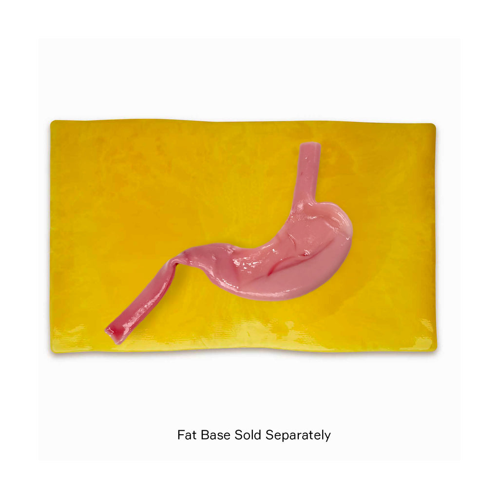 Gastric Model (Class II)