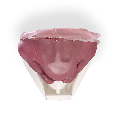 Hydrogel Surgical Training Model - Inguinal Hernia Class IV