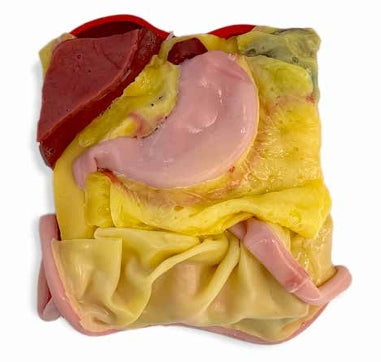 Hydrogel Surgical Training Model - Gastric Model Class IV