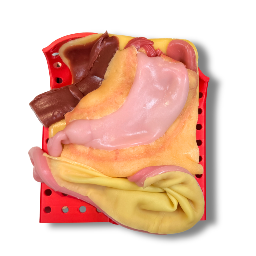 Gastric (Class IV)