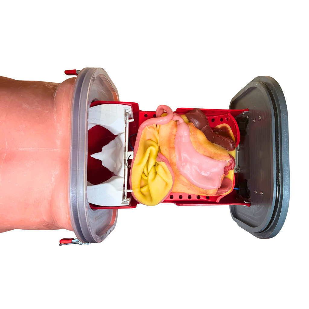 Gastric (Class IV)