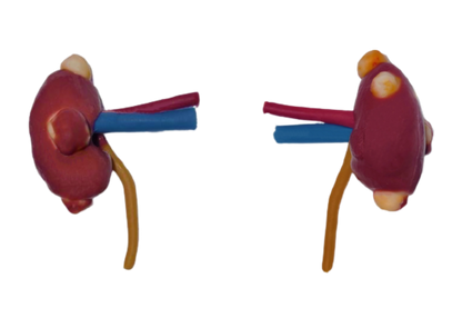 Partial Nephrectomy (Class IV)