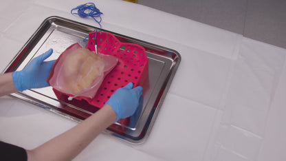 Partial Nephrectomy (Class IV)