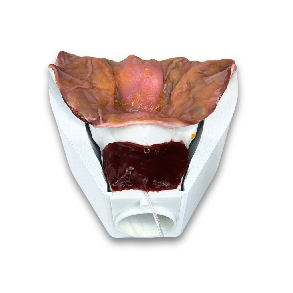 Prostate (Class V)