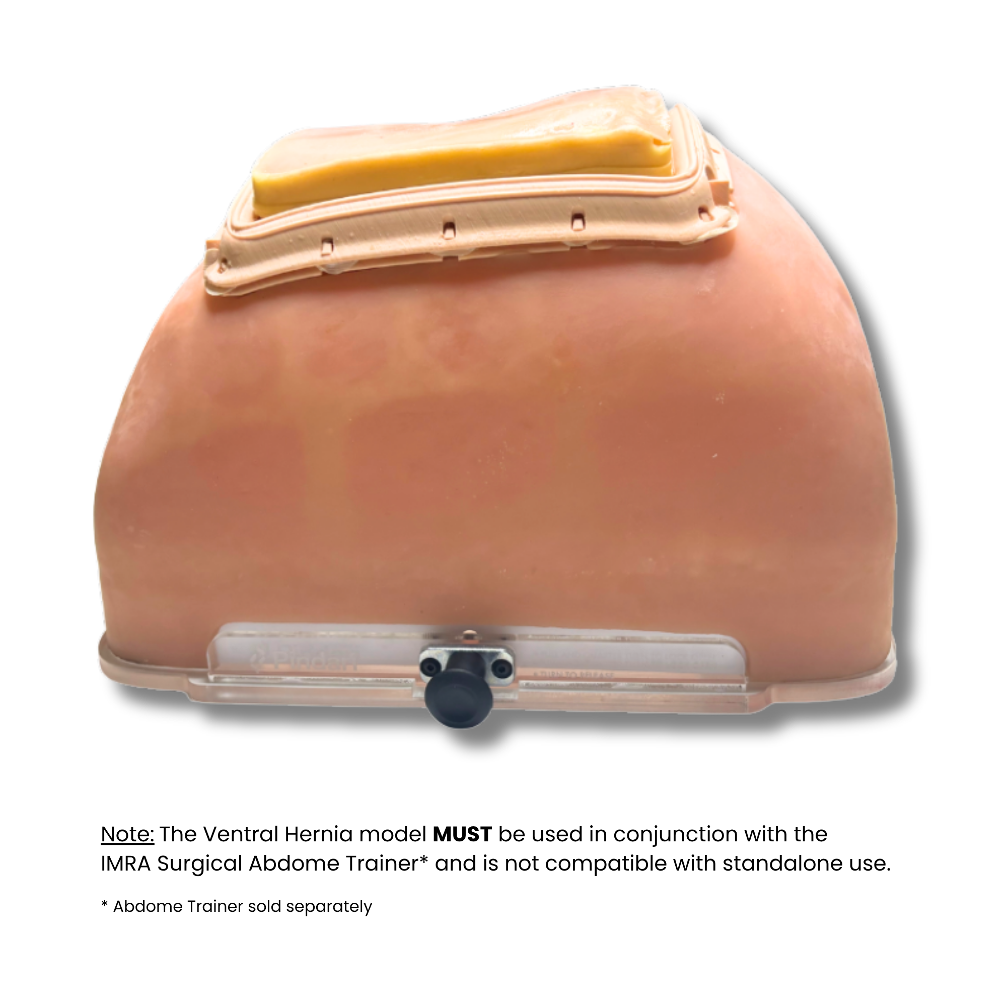 Ventral Hernia (Class II)